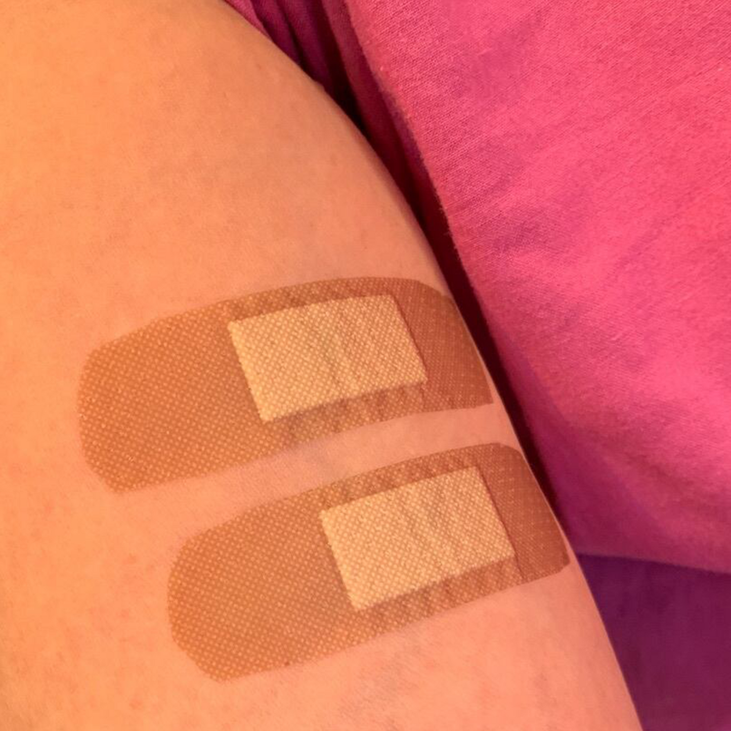 パッチテストキッド