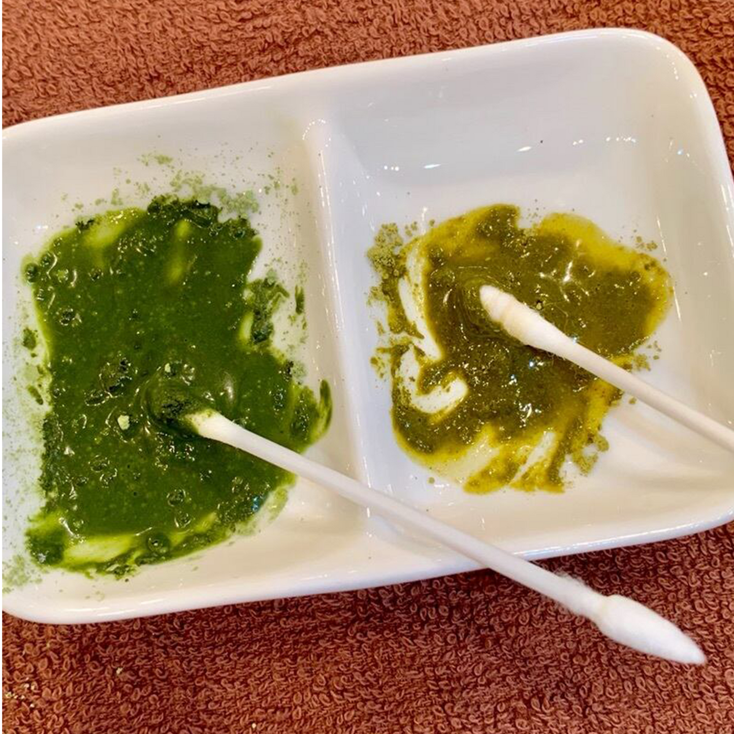 パッチテストキッド